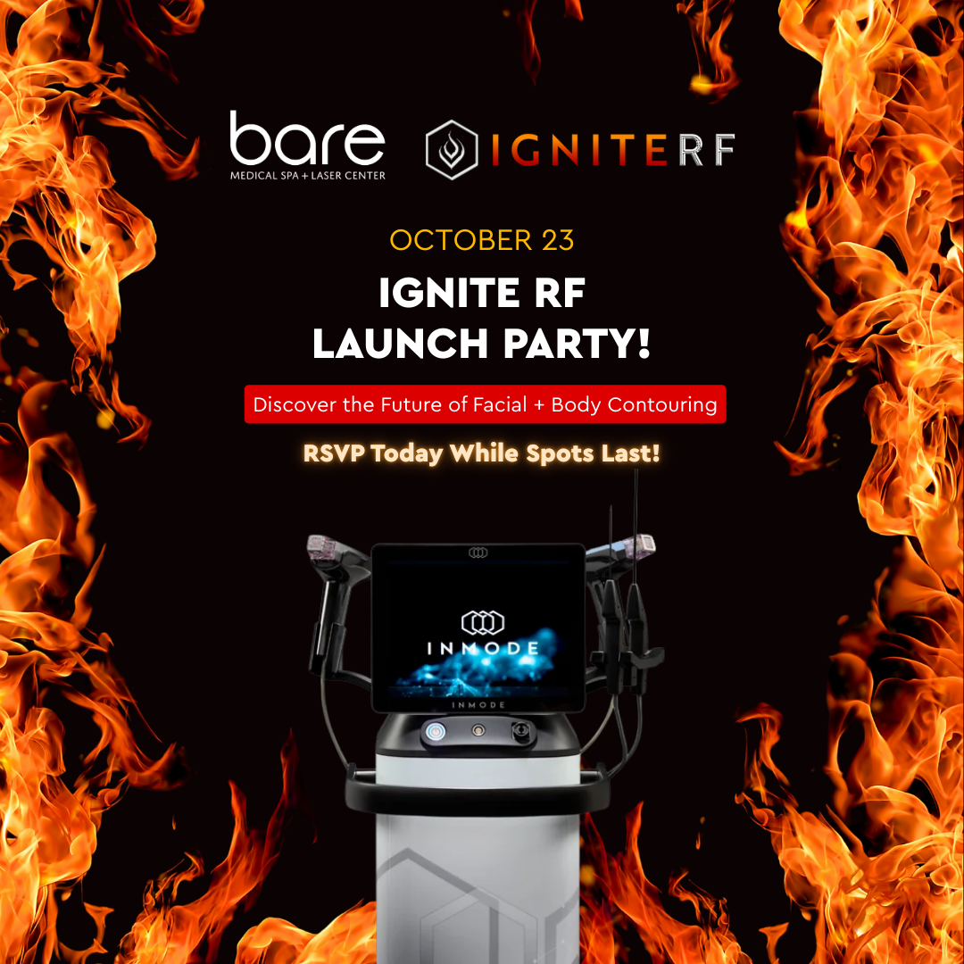Ignite RF Launch Party!
