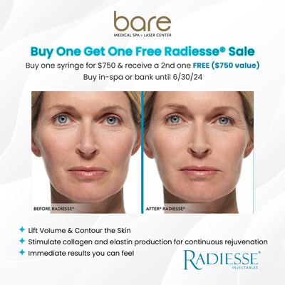 Radiesse sale banner at Bare Medical Spa