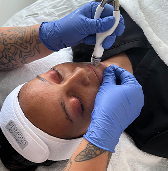 Client undergoing DiamondGlow at Bare MedSpa and Laser Center
